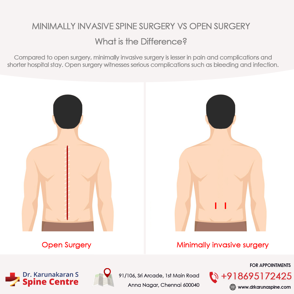 Open surgery vs. Minimally invasive spinal surgery